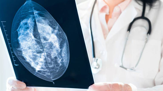 mammographie faux positifs