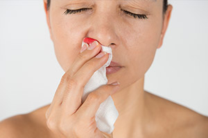 Cómo Detener la Hemorragia Nasal